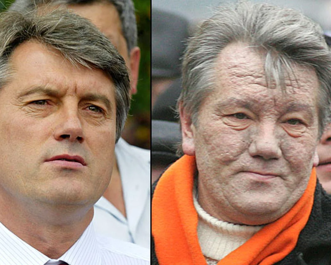 Viktor Yushchenko - Prima e dopo l'avvelenamento.